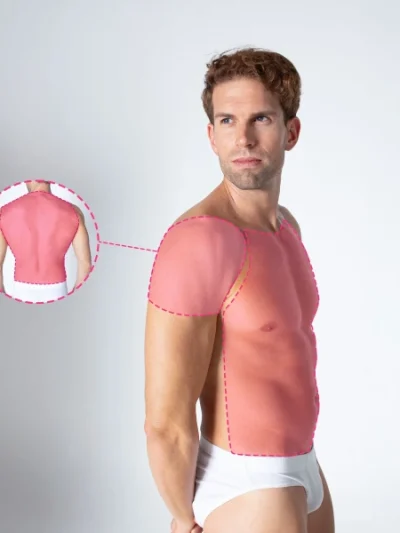 Depilação a laser masculina para costas, peito e ombros com tecnologia de díodo
