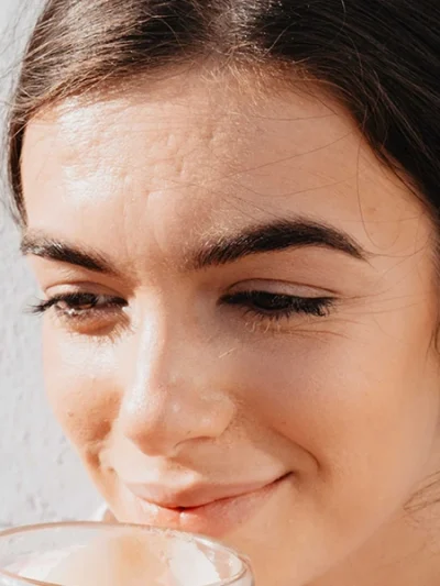 Depilação a laser no entrecejo feminino para remoção de vello facial entre as sobrancelhas