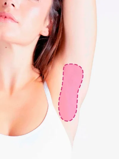 Depilação a laser nas axilas femininas com resultados duradouros, rápidos e praticamente indolores.