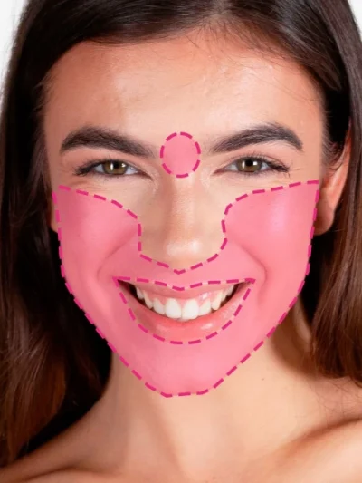 Depilação a laser de díodo em facial completo feminino com tecnologia avançada e resultados duradouros