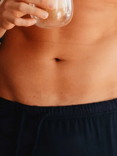 Depilação a laser da linha alba masculina com tecnologia de díodo de última geração